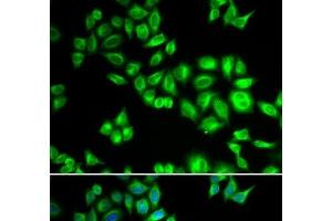 Immunofluorescence analysis of HeLa cells using CUL1 Polyclonal Antibody (Cullin 1 antibody)