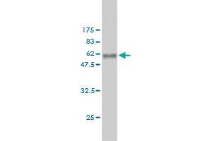 Western Blot detection against Immunogen (58. (RDH11 antibody  (AA 24-318))