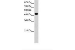 Image no. 1 for anti-Neuro-Oncological Ventral Antigen 2 (NOVA2) (N-Term) antibody (ABIN202654) (NOVA2 antibody  (N-Term))