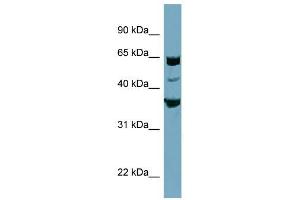 SEC22C antibody used at 1 ug/ml to detect target protein. (SEC22C antibody)