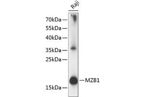 Western blot analysis of extracts of Raji cells, using MZB1 antibody (ABIN7268403) at 1:1000 dilution. (MZB1 antibody  (AA 1-189))