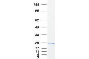 Cancer/testis Antigen Family 45, Member A2 (CT45A2) protein (Myc-DYKDDDDK Tag)