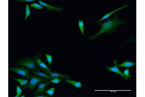 Immunofluorescence of purified MaxPab antibody to ADH5 on HeLa cell. (ADH5 antibody  (AA 1-374))