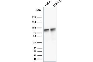 Western Blot Analysis of human HeLa and SK-BR3 cell lysate using Catenin, gamma Mouse Monoclonal Antibody (11E4). (JUP antibody)