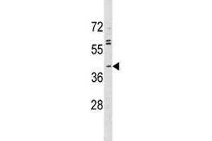 ABO antibody western blot analysis in MDA-MB231 lysate (ABO antibody  (AA 41-68))