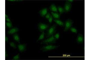 Immunofluorescence of monoclonal antibody to OXSR1 on HeLa cell. (OXSR1 antibody  (AA 1-527))