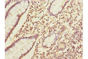 Immunohistochemistry of paraffin-embedded human small intestine tissue using ABIN7156265 at dilution of 1:100