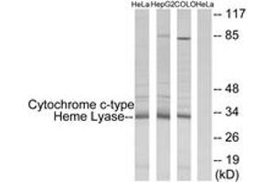 Western blot analysis of extracts from HeLa/HepG2/COLO cells, using Cytochrome c-type Heme Lyase Antibody. (HCCS antibody  (AA 81-130))