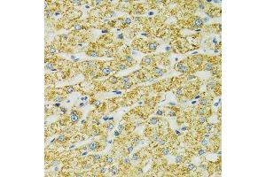 Immunohistochemistry of paraffin-embedded human liver using HSPA9 antibody.