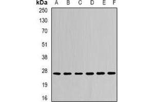 Western blot analysis of CDC34B expression in Jurkat (A), MCF7 (B), mouse liver (C), mouse kidney (D), rat brain (E), rat lung (F) whole cell lysates.