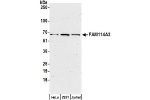 anti-Family with Sequence Similarity 114, Member A2 (FAM114A2) (AA 25-75) antibody