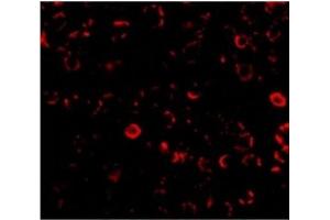 Immunofluorescence of TLR3 in El4 cells with CD283 / TLR3 antibody at 10 ug/ml.