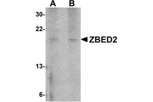 Western Blotting (WB) image for anti-Zinc Finger, BED-Type Containing 2 (ZBED2) (N-Term) antibody (ABIN1031669) (ZBED2 antibody  (N-Term))