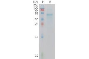 IL23A Protein (AA 22-196) (Fc Tag)