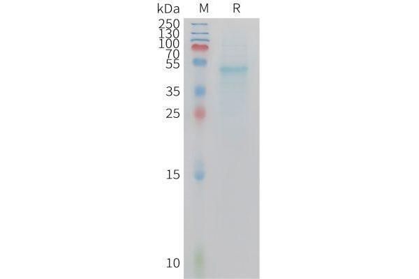IL23A Protein (AA 22-196) (Fc Tag)