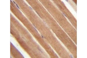 EphB2 antibody analysis in formalin fixed and paraffin embedded human skeletal muscle (EPH Receptor B2 antibody  (AA 103-133))