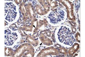 Image no. 3 for anti-Fatty Acid Binding Protein 3, Muscle and Heart (FABP3) (AA 46-95) antibody (ABIN202026)