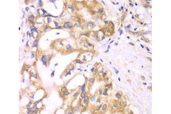 ACADS antibody