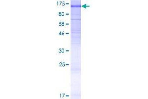 Anoctamin 6 Protein (ANO6) (AA 1-910) (GST tag)