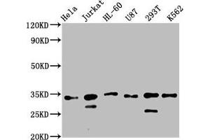 Western Blot Positive WB detected in: Hela whole cell lysate, Jurkat whole cell lysate, HL60 whole cell lysate, U87 whole cell lysate, 293T whole cell lysate, K562 whole cell lysate All lanes: TSNAX antibody at 2. (TSNAX antibody  (AA 1-87))