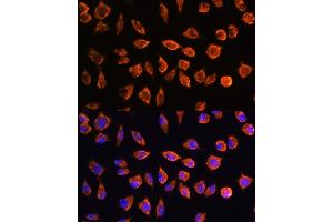 Immunofluorescence analysis of L929 cells using NOTCH3 Rabbit pAb (ABIN1681077, ABIN3015390, ABIN3015391 and ABIN6214032) at dilution of 1:100. (NOTCH3 antibody  (AA 751-850))