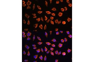 Immunofluorescence analysis of L929 cells using NOTCH3 Rabbit pAb (ABIN1681077, ABIN3015390, ABIN3015391 and ABIN6214032) at dilution of 1:100. (NOTCH3 antibody  (AA 751-850))