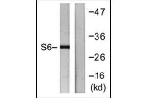 Western blot analysis of extracts from HeLa cells, treated with TNF-a 20ng/ml 2', using. (RPS6 antibody  (C-Term))