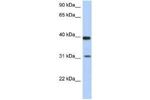 WB Suggested Anti-RPSA Antibody Titration: 0.