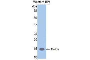Western Blotting (WB) image for anti-Leukemia Inhibitory Factor Receptor alpha (LIFR) (AA 381-485) antibody (ABIN1859656) (LIFR antibody  (AA 381-485))