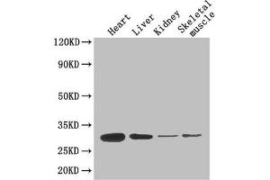 Western Blot Positive WB detected in: Mouse heart tissue, Mouse liver tissue, Mouse kidney tissue, Mouse skeletal muscle tissue All lanes: ADIPOQ antibody at 4 μg/mL Secondary Goat polyclonal to rabbit IgG at 1/50000 dilution Predicted band size: 27 kDa Observed band size: 27 kDa (ADIPOQ antibody  (AA 19-244))