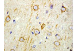 Anti-GAD65 antibody, IHC(P): Rat Brain Tissue