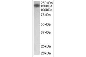 Staining of Human Colon lysate (35µg protein in RIPA buffer) using MYLK antibody at0. (MYLK antibody  (Internal Region))