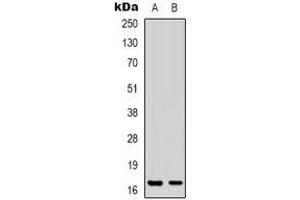 Western blot analysis of CPI17 expression in Jurkat (A), HT29 (B) whole cell lysates. (CPI-17 antibody  (N-Term))