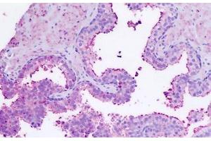 RXFP1 antibody  (C-Term)