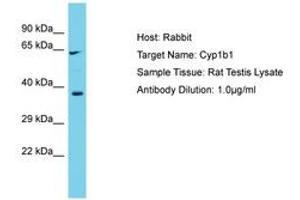 Image no. 1 for anti-Cytochrome P450, Family 1, Subfamily B, Polypeptide 1 (CYP1B1) (AA 294-343) antibody (ABIN6750328)