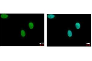 ICC/IF Image DNA ligase III antibody detects LIG3 protein at nucleus by immunofluorescent analysis.