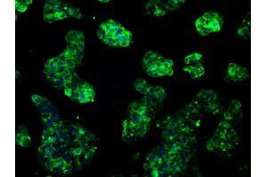 Immunofluorescent staining of HeLa cells using anti-RNF144B mouse monoclonal antibody (ABIN2453607).