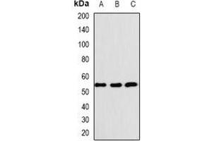 Western blot analysis of BAF57 expression in K562 (A), SHSY5Y (B), SKOV3 (C) whole cell lysates. (SMARCE1 antibody)