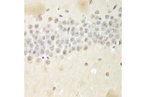Immunohistochemistry of paraffin-embedded mouse brain using Nono Antibody (ABIN5973035) at dilution of 1/100 (40x lens). (NONO antibody)