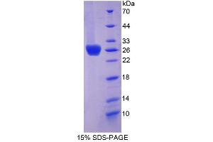 Image no. 1 for Coxsackie Virus and Adenovirus Receptor (CXADR) (AA 20-229) protein (His tag) (ABIN6237585) (Coxsackie Adenovirus Receptor Protein (AA 20-229) (His tag))