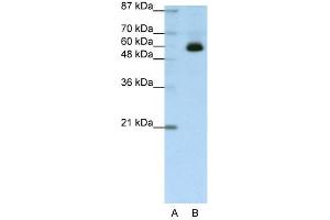 WB Suggested Anti-ZNF307 Antibody Titration:  1. (ZKSCAN4 antibody  (C-Term))