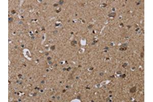 The image on the left is immunohistochemistry of paraffin-embedded Human brain tissue using ABIN7192919(TRPM1 Antibody) at dilution 1/20, on the right is treated with synthetic peptide. (TRPM1 antibody)