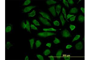 Immunofluorescence of monoclonal antibody to CFLAR on HeLa cell. (FLIP antibody  (AA 178-277))