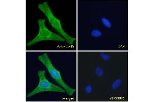 ABIN6391356 Immunofluorescence analysis of paraformaldehyde fixed HeLa cells, permeabilized with 0. (Cadherin 5 antibody  (Internal Region))