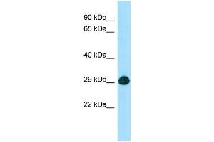 WB Suggested Anti-SLC25A2 Antibody Titration: 1. (SLC25A2 antibody  (C-Term))