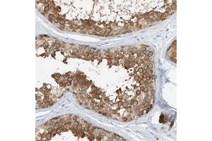 Immunohistochemical staining of human testis with ARD1B polyclonal antibody  shows distinct cytoplasmic positivity in seminiferus duct cells at 1:500-1:1000 dilution.