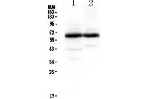 Western blot analysis of Synaptotagmin 1 using anti-Synaptotagmin 1 antibody . (SYT1 antibody)
