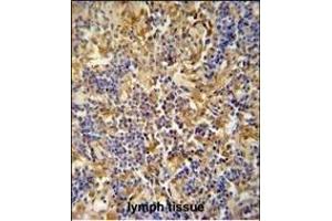 IBTK antibody (Center) (ABIN654688 and ABIN2844380) immunohistochemistry analysis in formalin fixed and paraffin embedded human lymph tissue followed by peroxidase conjugation of the secondary antibody and DAB staining. (IBTK antibody  (AA 586-613))
