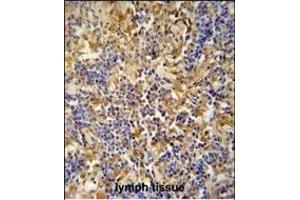 IBTK antibody (Center) (ABIN654688 and ABIN2844380) immunohistochemistry analysis in formalin fixed and paraffin embedded human lymph tissue followed by peroxidase conjugation of the secondary antibody and DAB staining. (IBTK antibody  (AA 586-613))