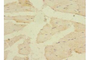 Immunohistochemistry of paraffin-embedded human skeletal muscle tissue using ABIN7175582 at dilution of 1:100